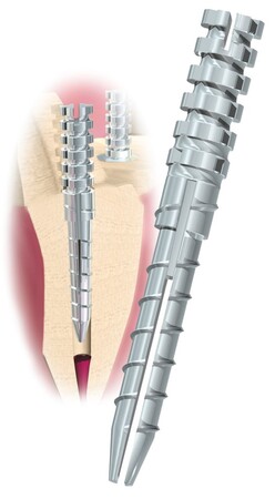 EDS Flexi Post titan #3 zielone 10+1