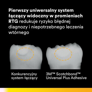 Scotchbond Universal Plus Adhesive 5 ml RABAT 6