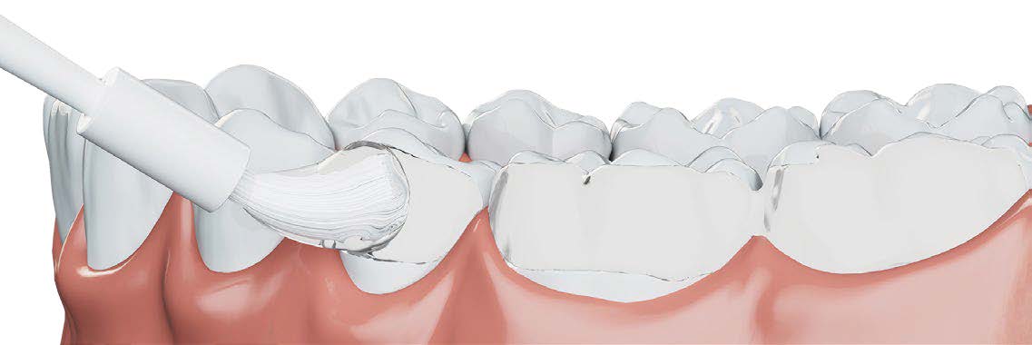 3M™ Clinpro™ Clear