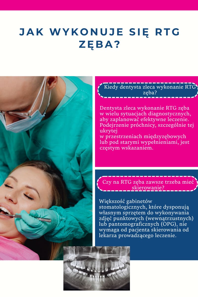 Jak wykonuje się rtg zęba?