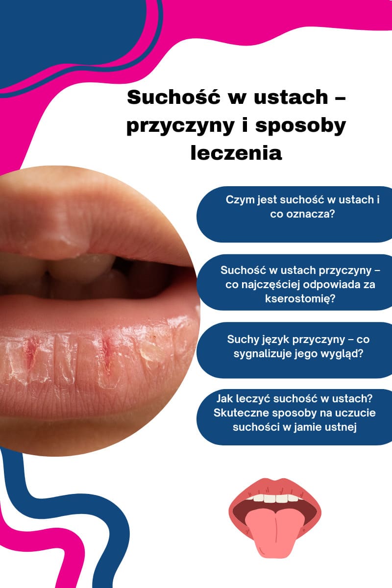 Czym jest suchość w ustach?