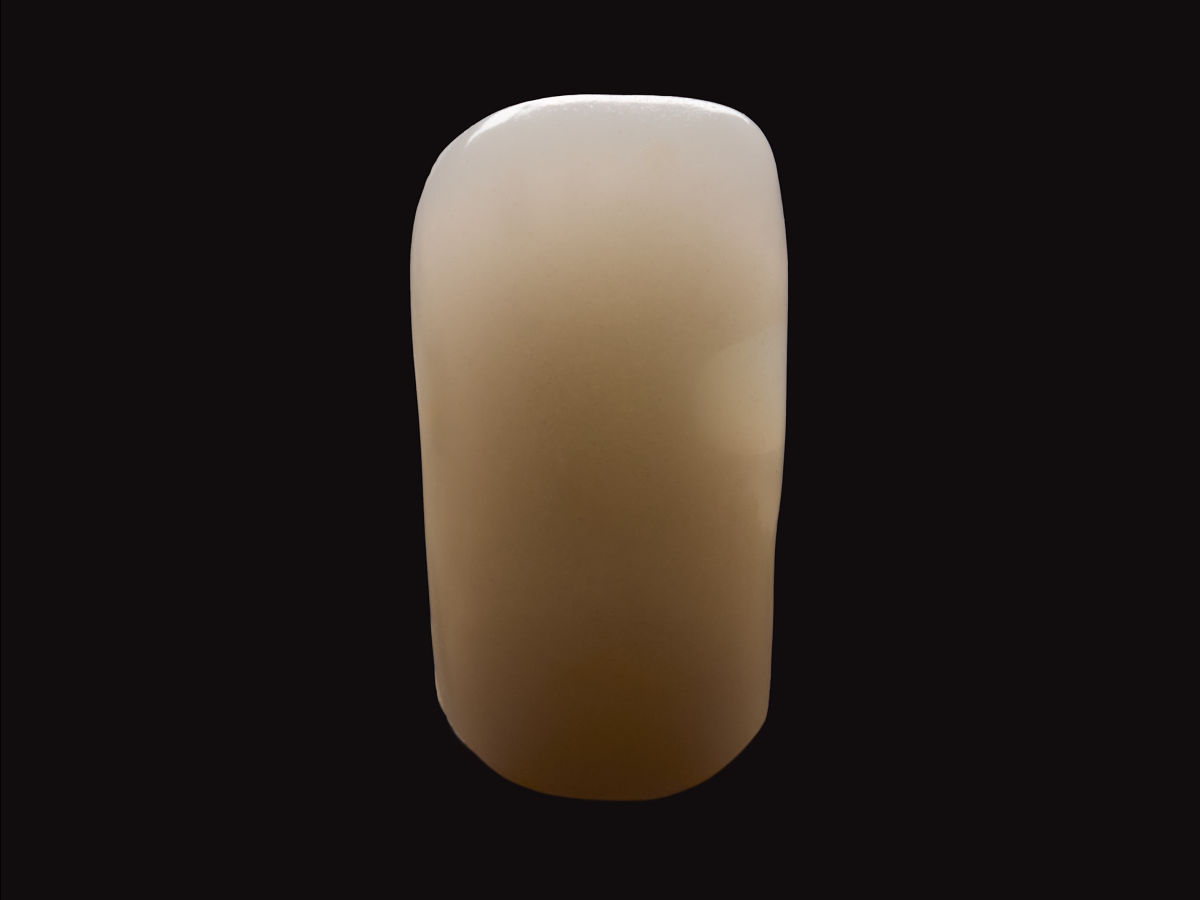 Konkurencja z blokerem