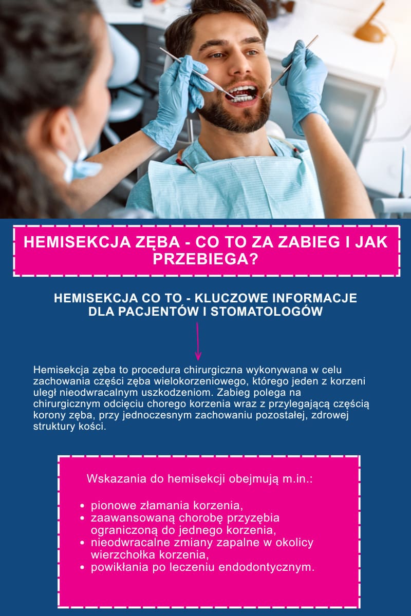 Hemisekcja zęba - co to za zabieg i jak przebiega?