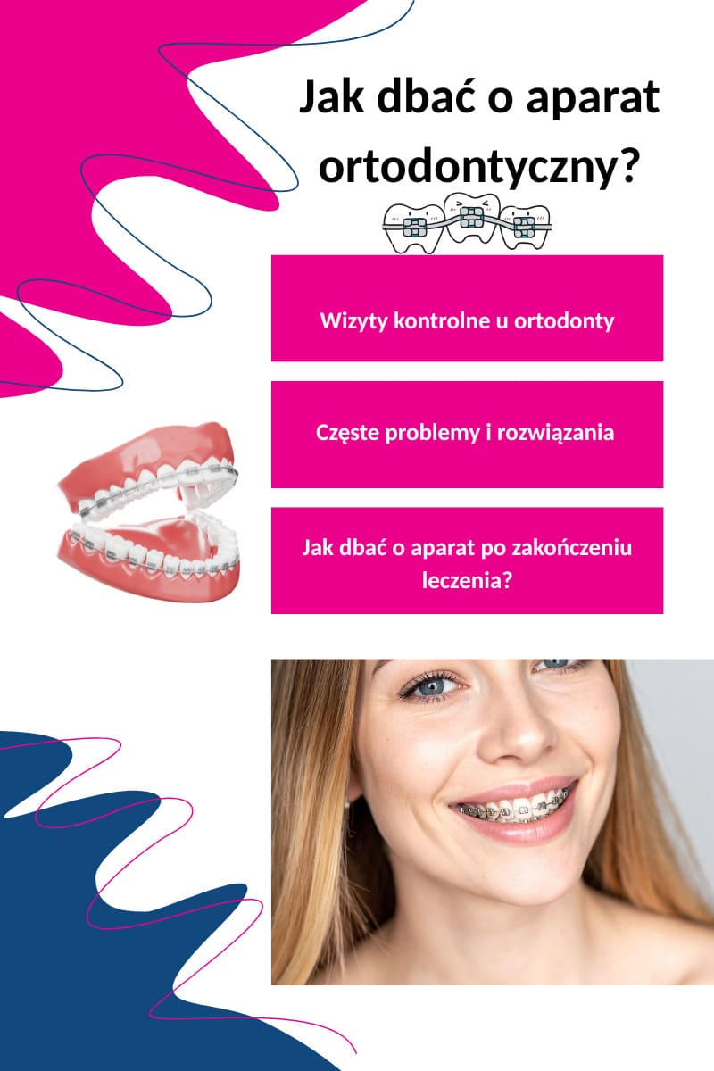 Jak dbać o aparat ortodontoczny?