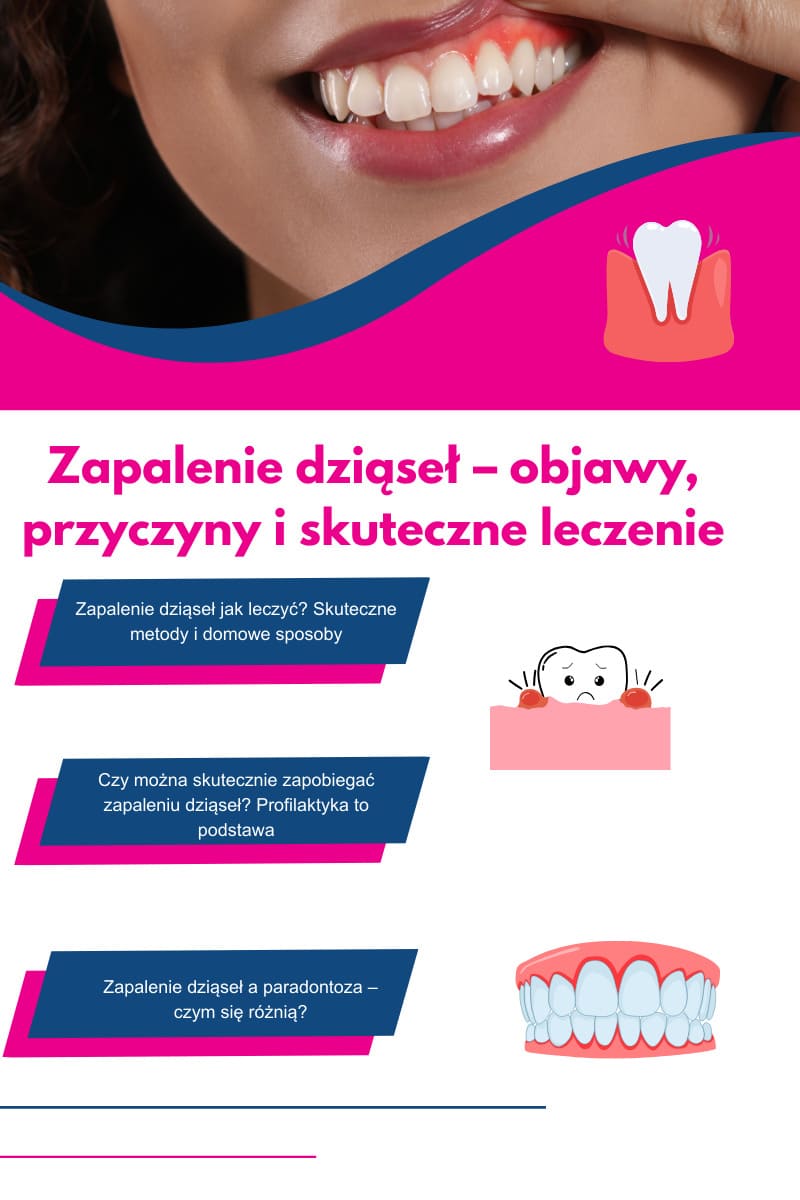 Jak leczyć&nbsp;zapalenie dziąseł?