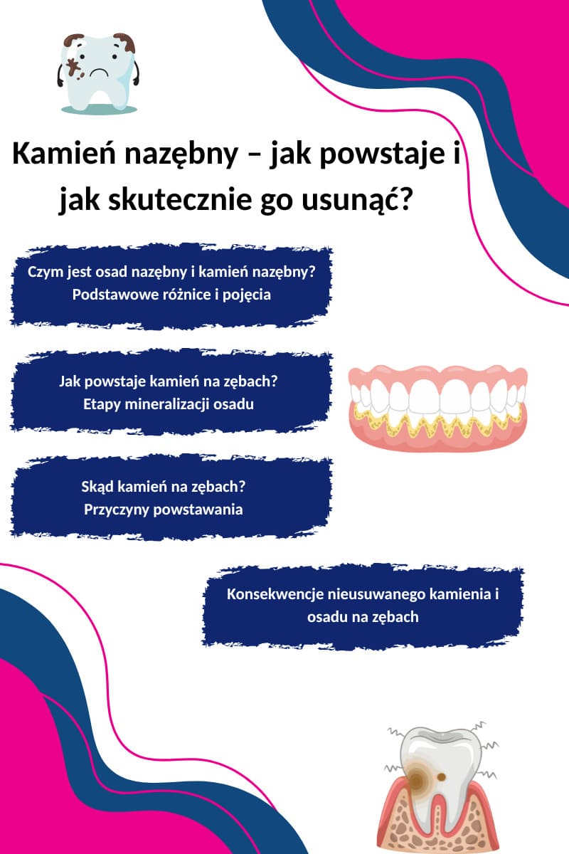 Jak powstaje kamień nazębny?
