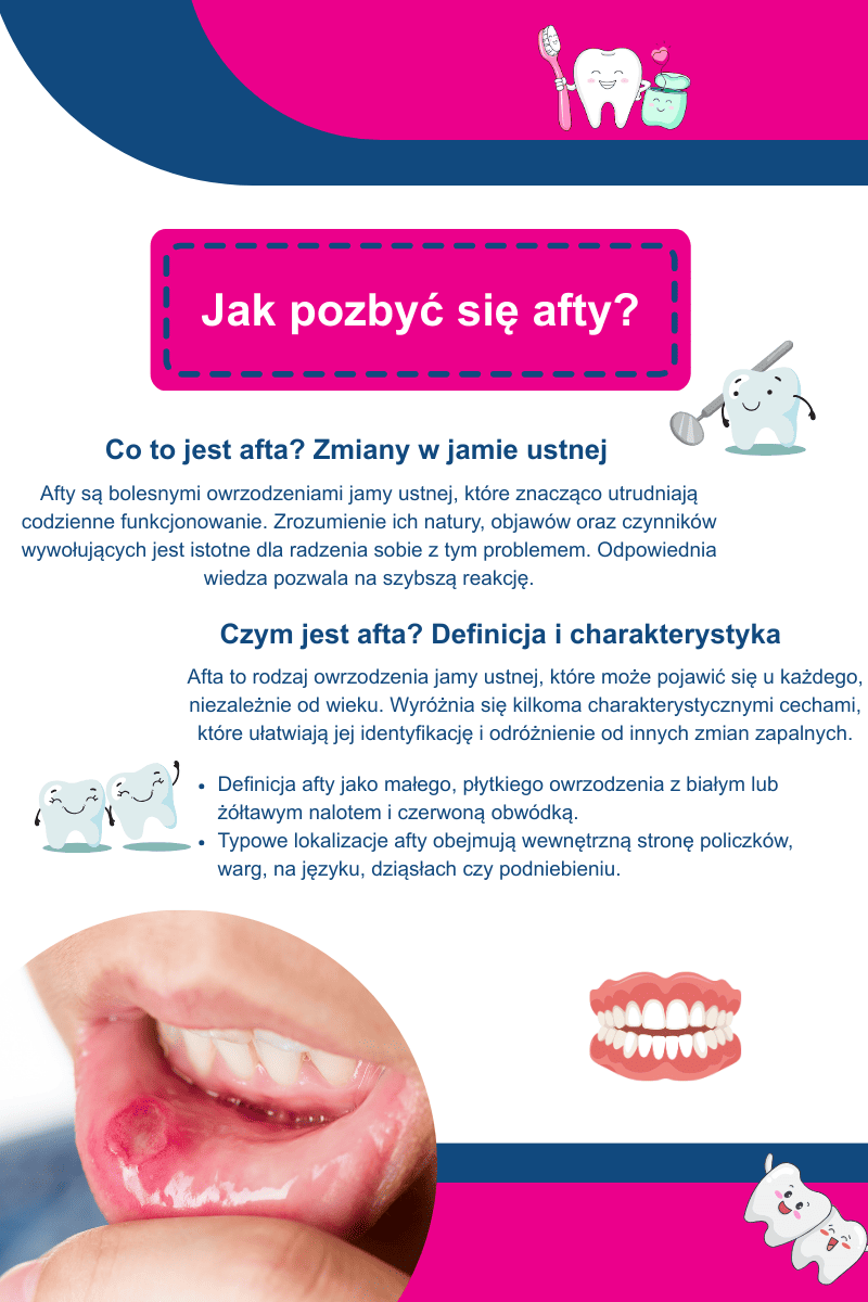 Czym są&nbsp;afty