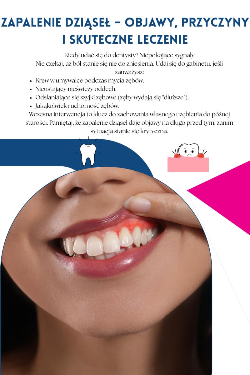 Kiedy wybrać się&nbsp;do specjalisty z krawieniem dziąseł?