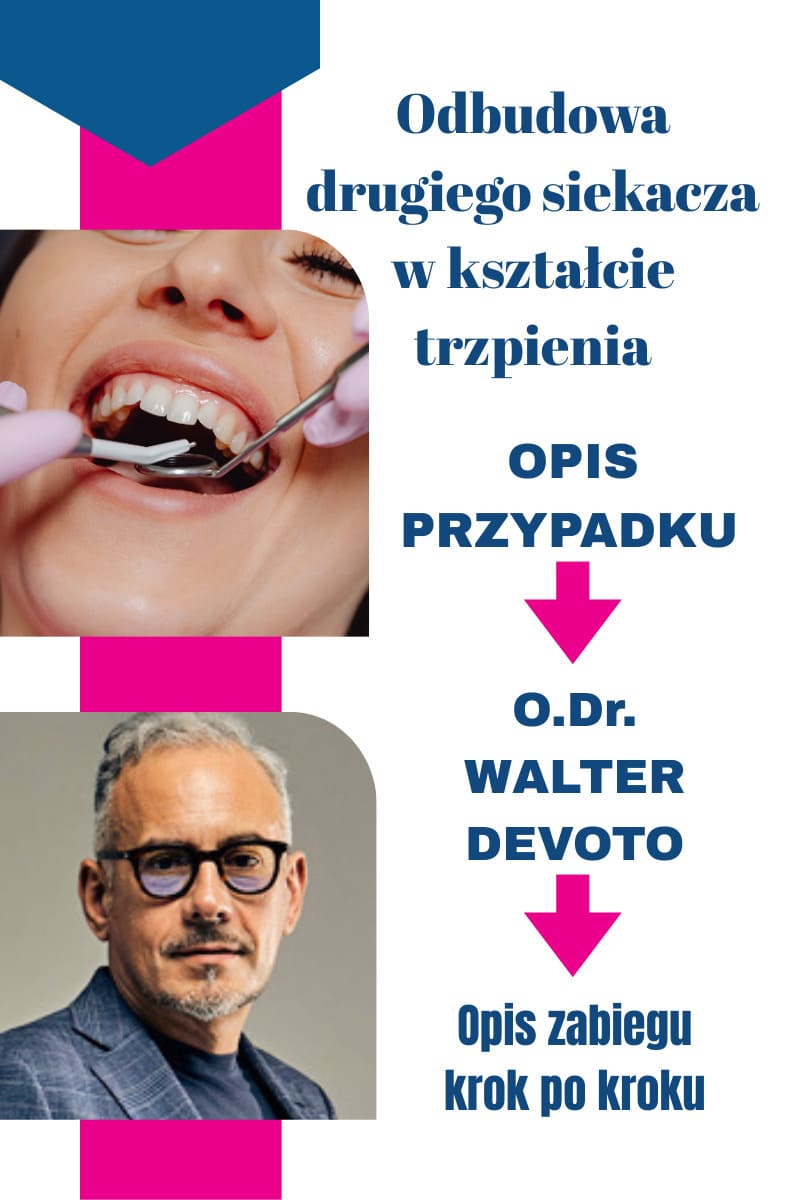 Odbudowa drugiego siekacza w kształcie trzpienia