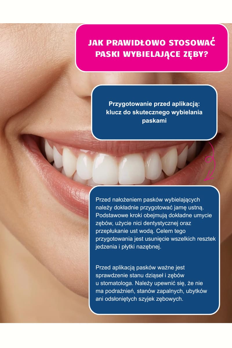 Jak prawidłowo stosować paski wybielające zęby?