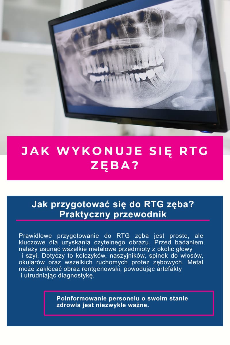 Jak przygotować się do rtg zęba